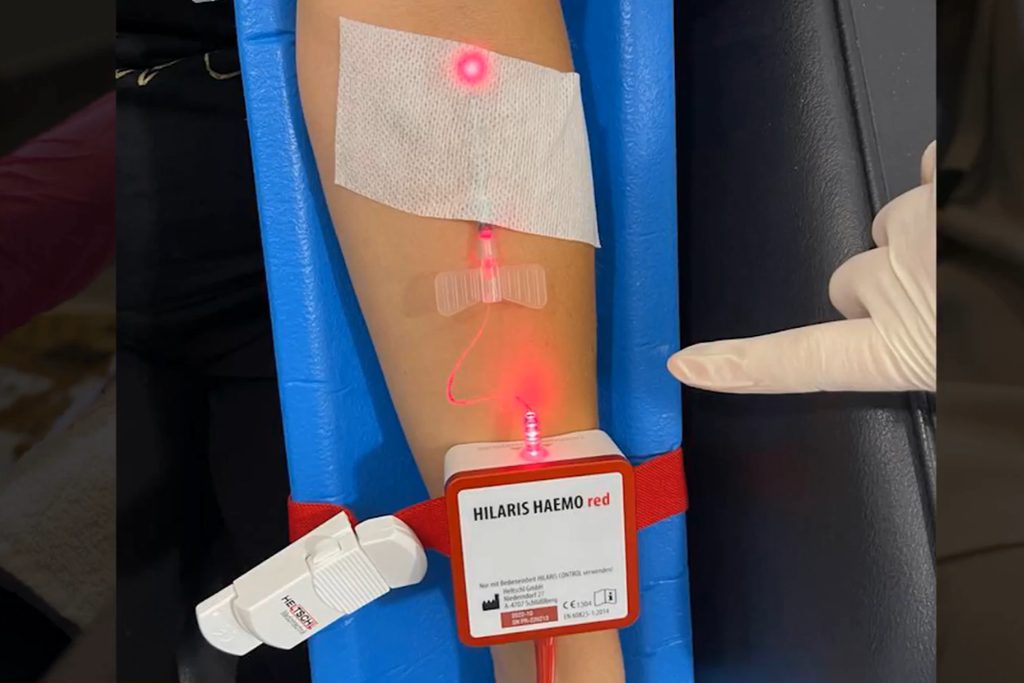 Terapia Endovenosa com Laser